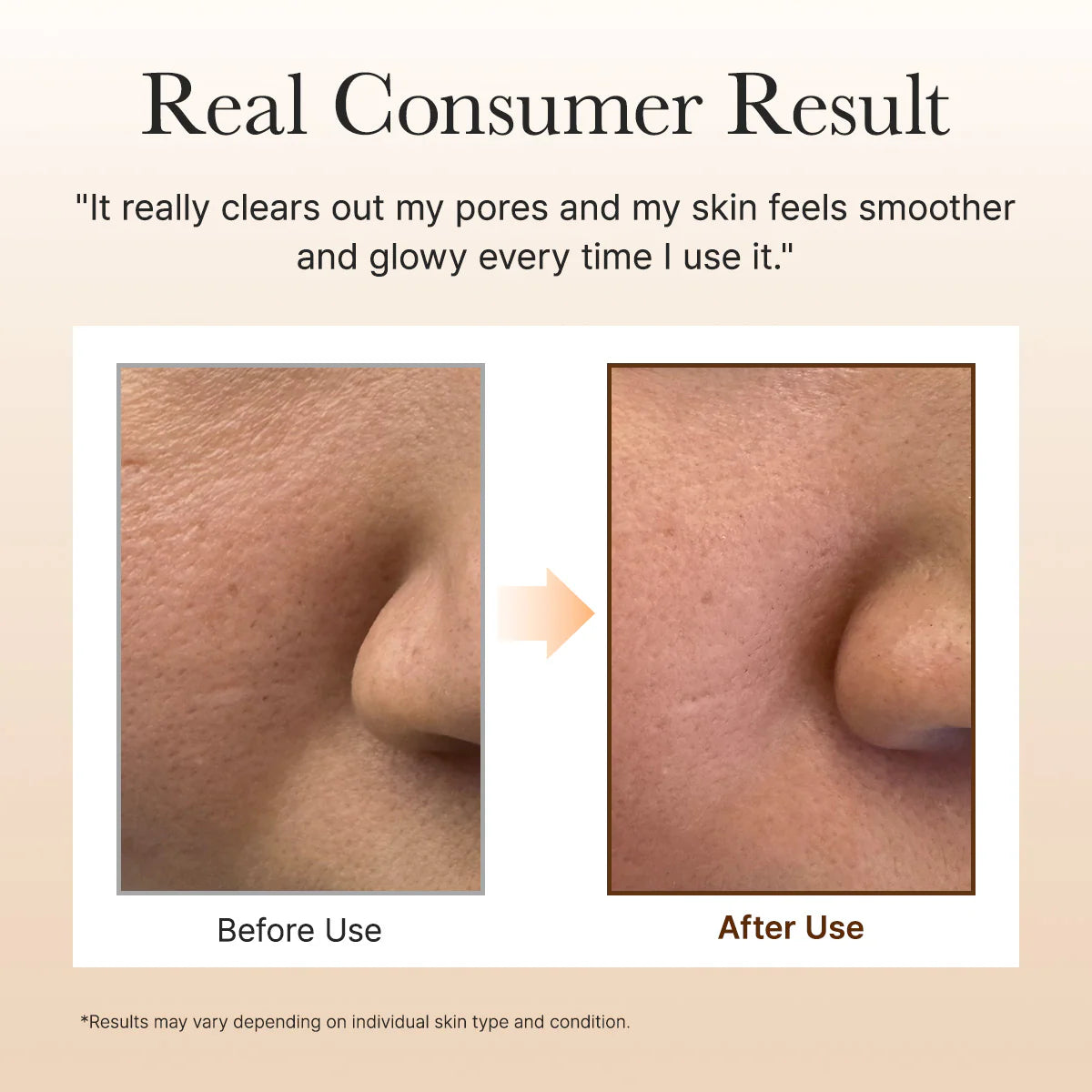 Calendula Rice Mochi Cleanser (120 g) / Arencia