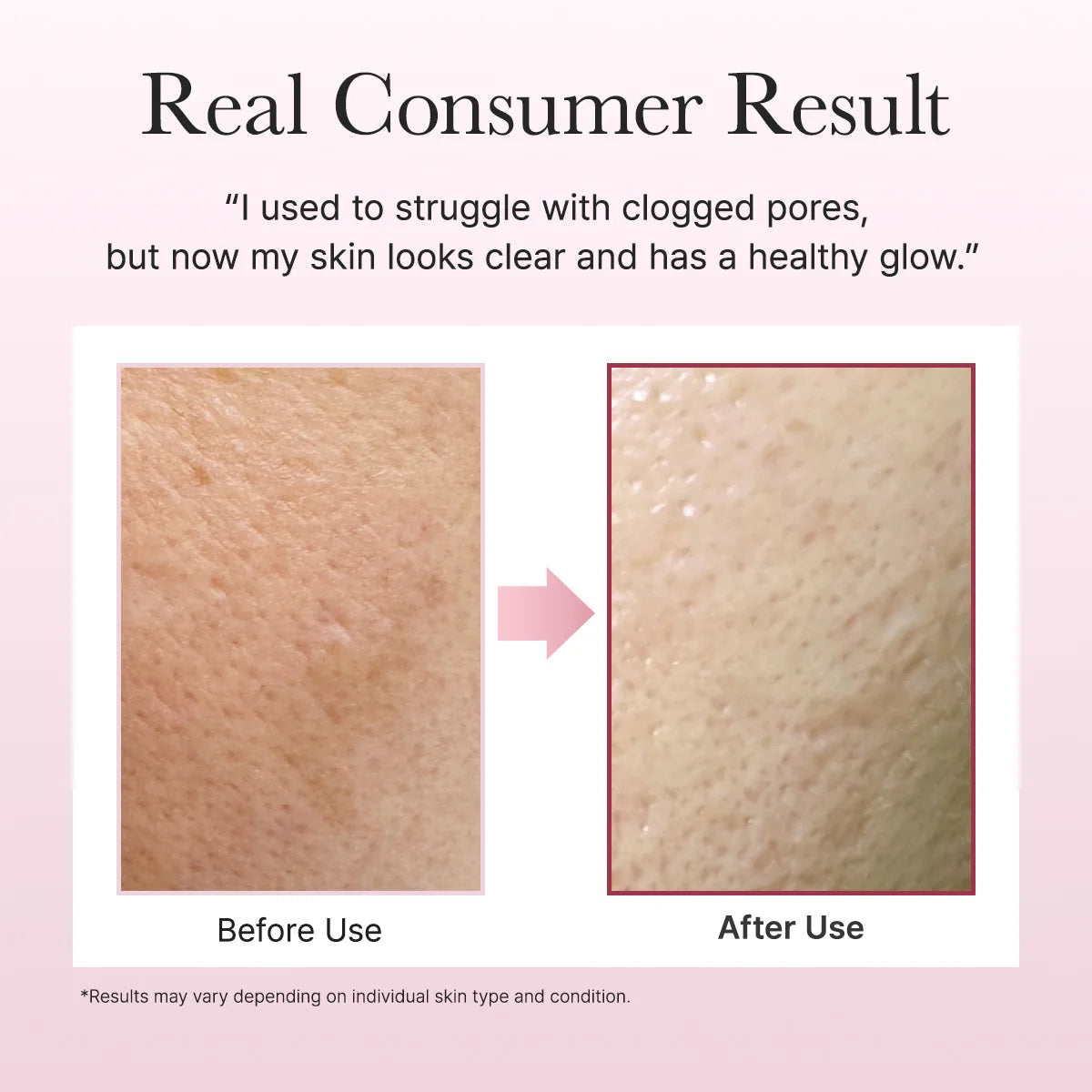 Fresh Rosehip Mochi Cleanser (120 g) / Arencia