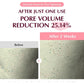 Collagen Pore-tight Up Hydrogel Mask (30 g) / Eqqualberry