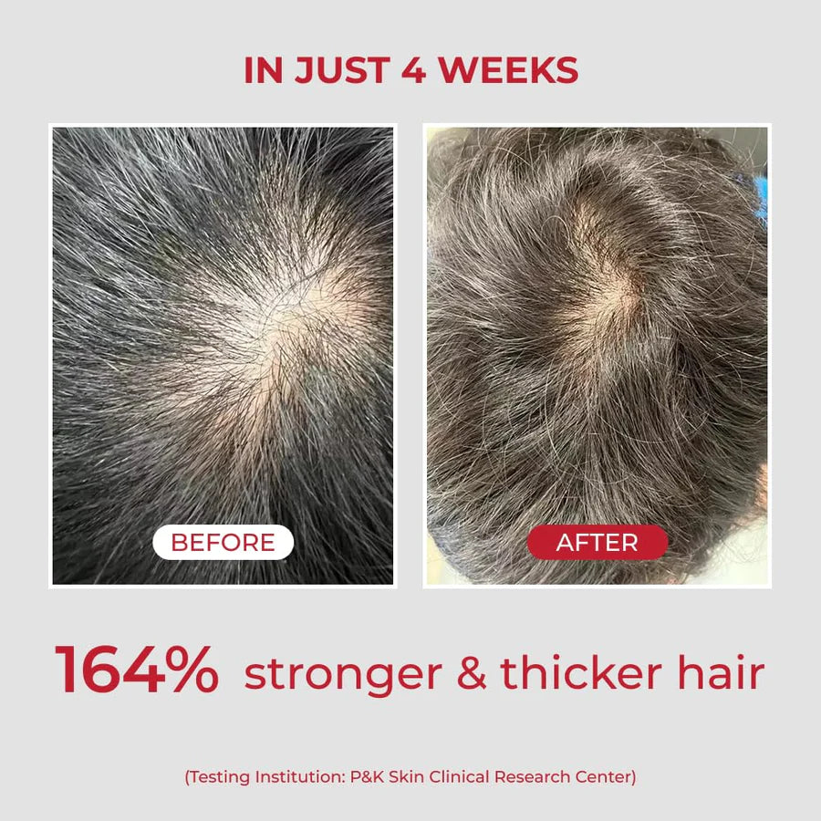 Annucartin Shampoo / Moev