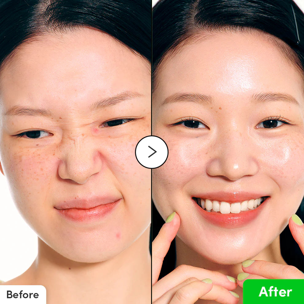 Aloe PDRN Calming Serum / Eqqualberry