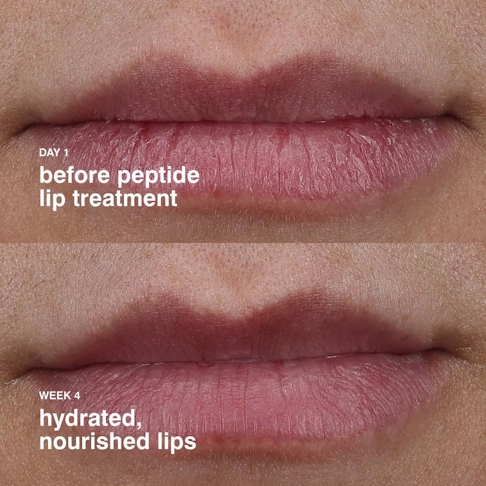 Peptide Lip Treatment / Rhode