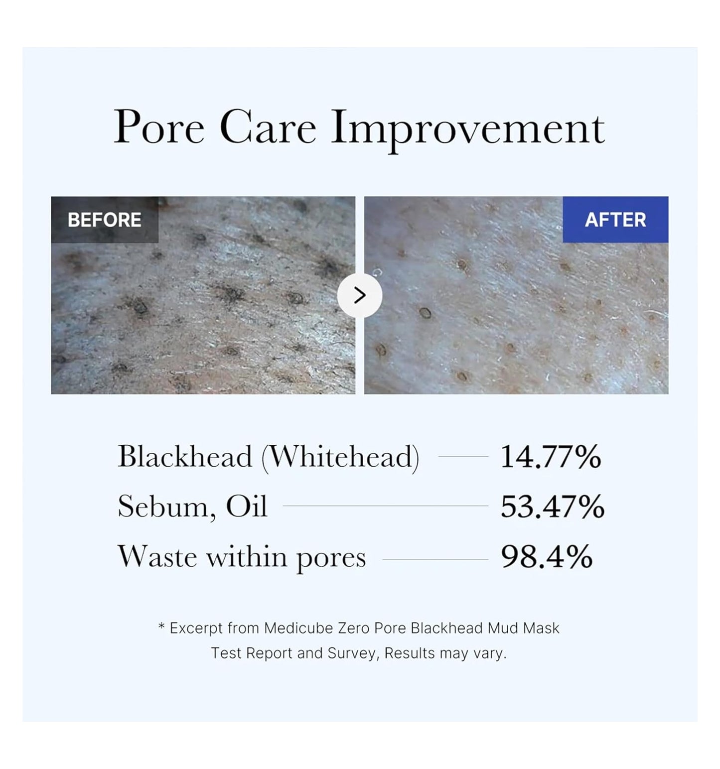 Zero Pore Blackhead Mud Mask / Medicube