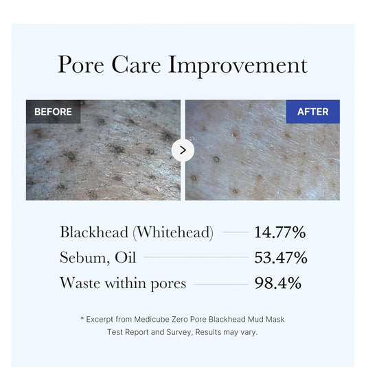 Zero Pore Blackhead Mud Mask / Medicube