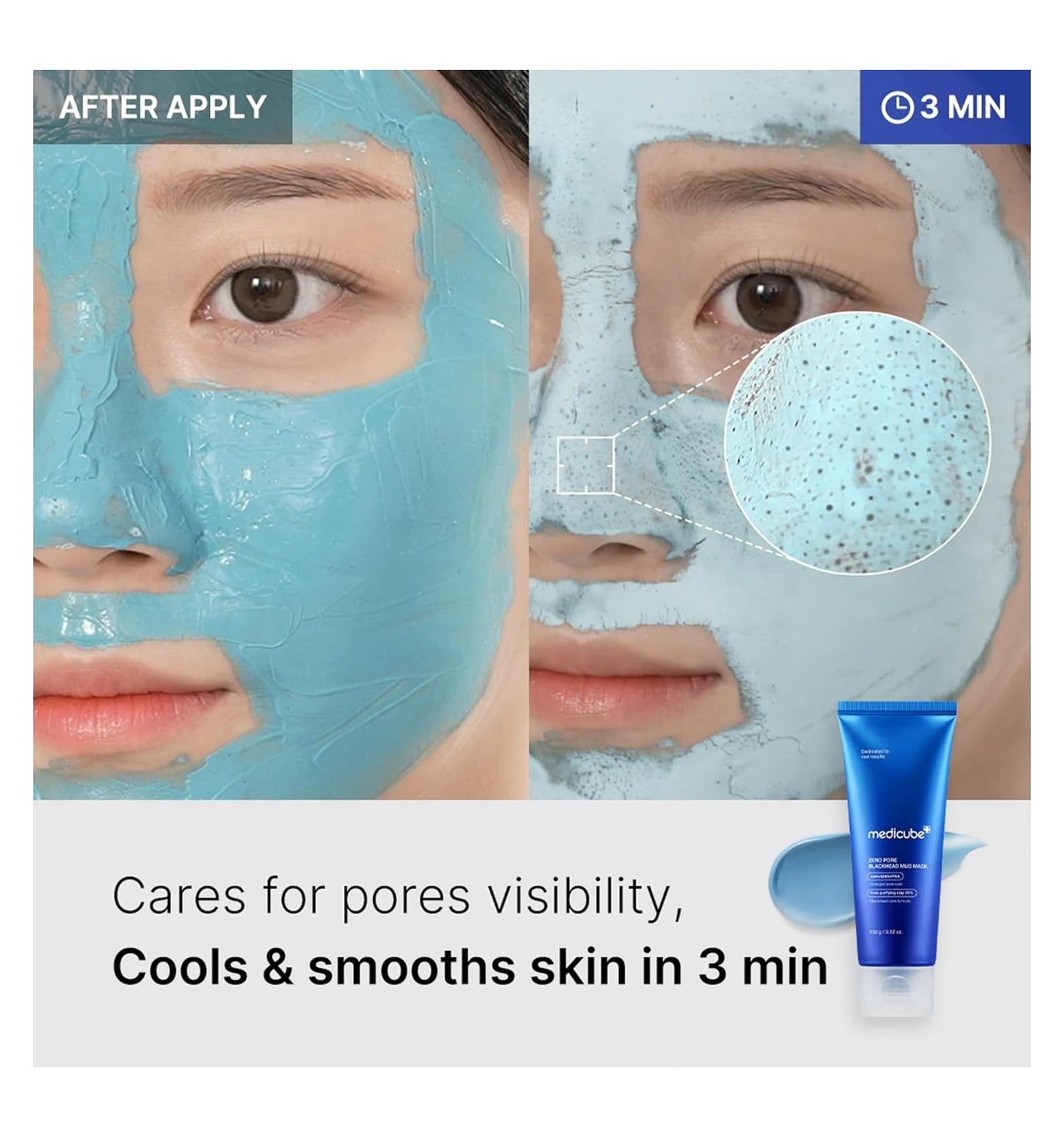 Zero Pore Blackhead Mud Mask / Medicube